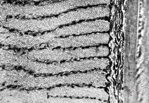 Oxyuris vermicularis - muscular wall Oxyuris vermicularis - muscular wall